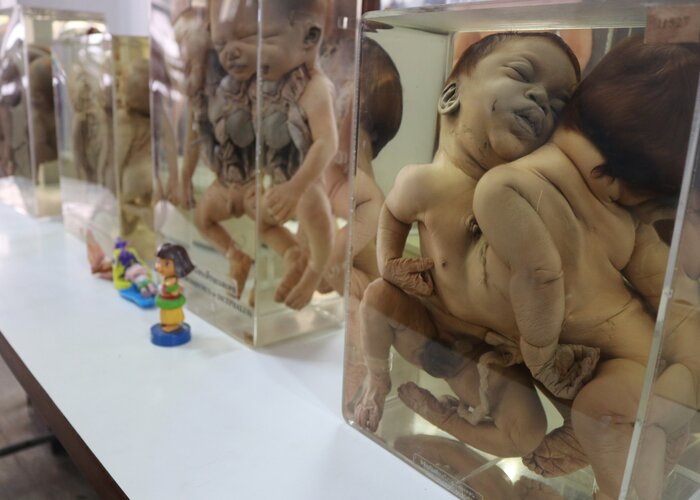 Siriraj Medical Museum