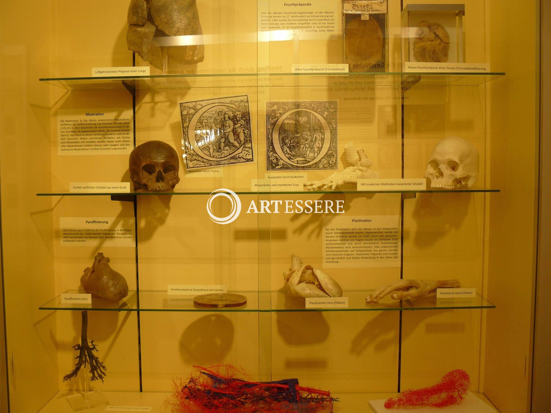 Anatomical Museum of the University of Basel